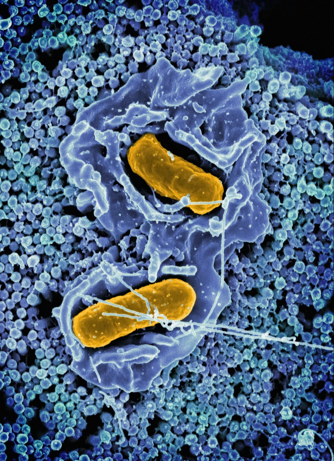 Microscopic view of bacteria and viruses